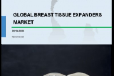 Want To Know About The Latest Trend In Breast Tissue Expanders Market? | Technavio
