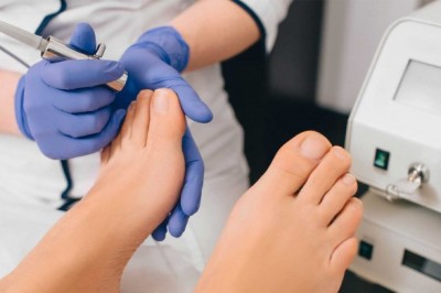 what is toenail fungus and how to treat